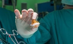 Biological aortic valves do not last indefinitely!