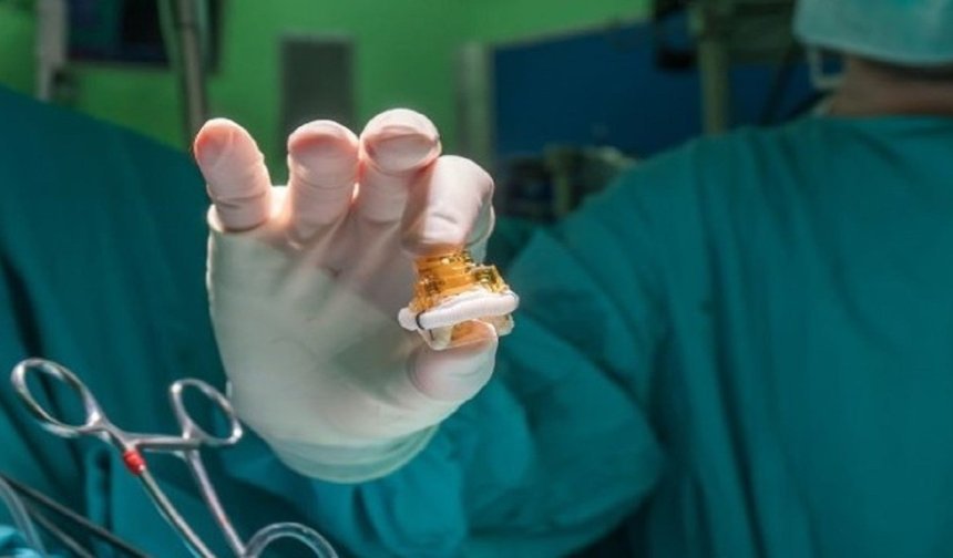 Biological aortic valves do not last indefinitely!