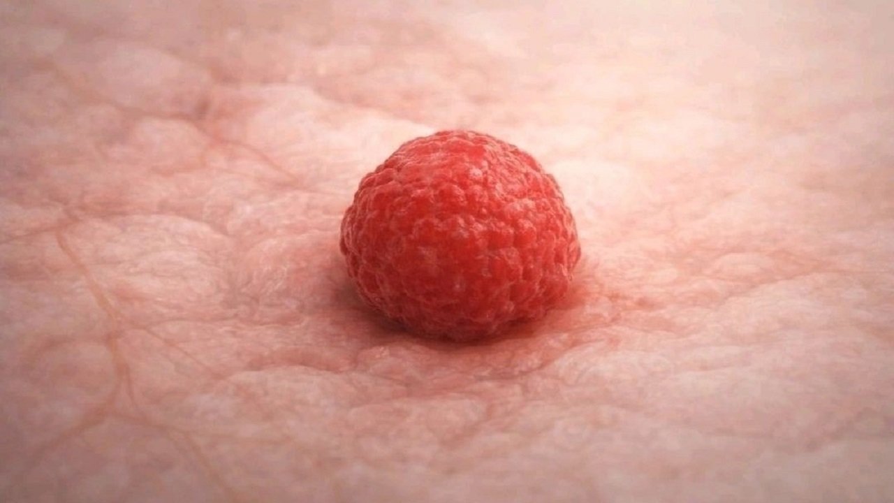 How does cancer actually develop?